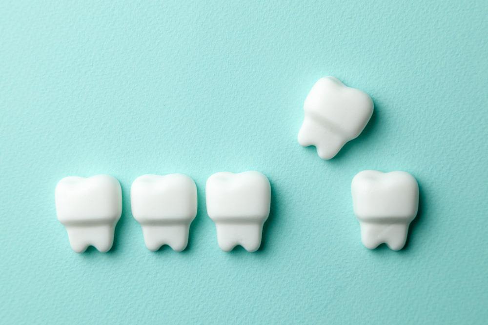 Des mythes sur la perte dentaire