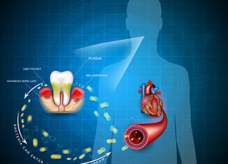 La relation entre la santé buccodentaire et les maladies cardiovasculaires